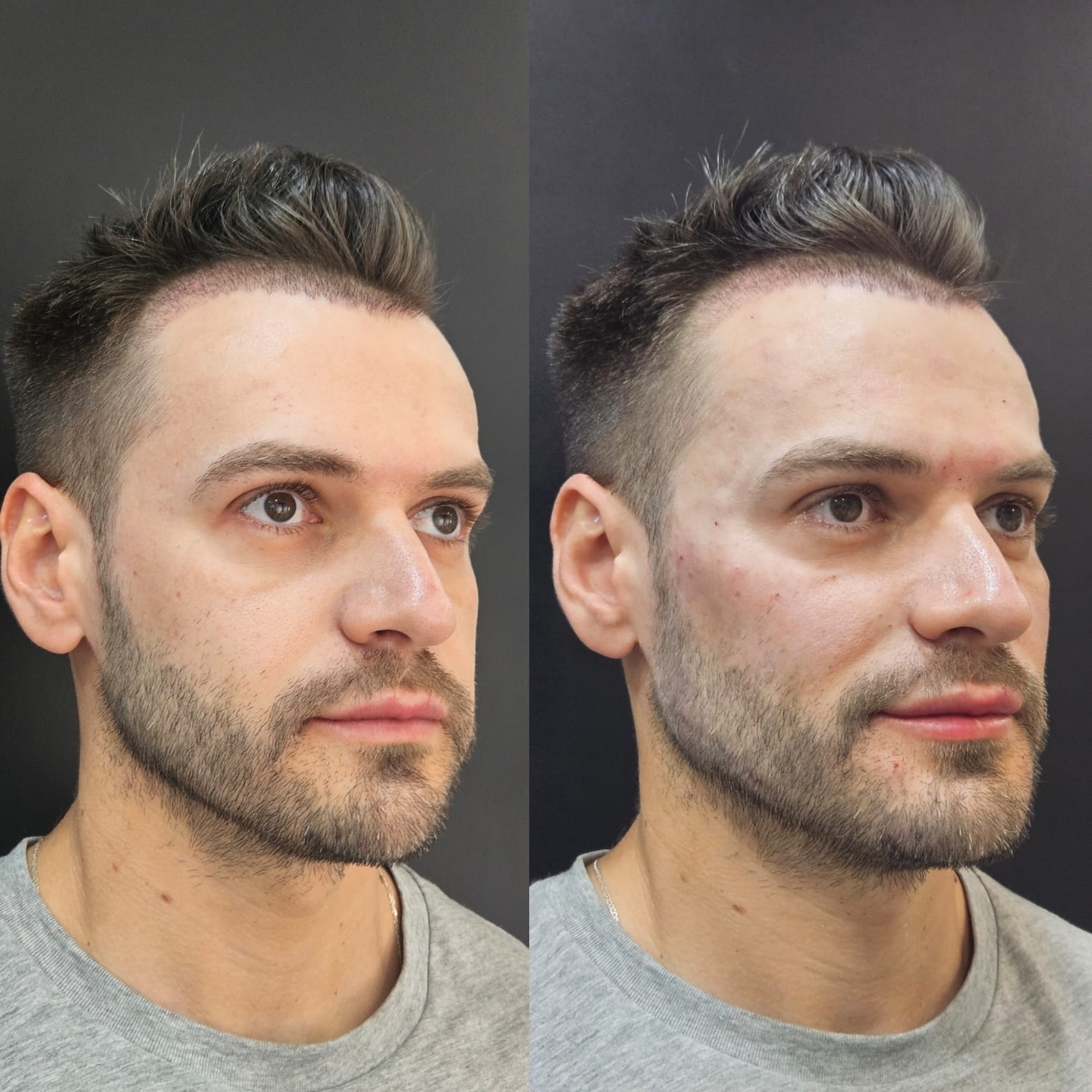 Rosto feminino com pele radiante e cuidada